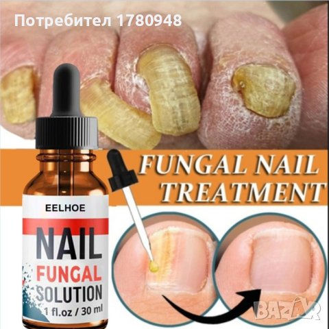 Продукт за лечение на гъбички по ноктите E e l h o e  0.30 мл., снимка 1