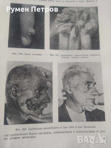 Дерматология и венерология, снимка 4 - Специализирана литература - 31636141