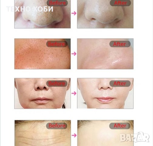 Козметична Фотонна LED маска за лице терапия за бръчки акне пори фотон, снимка 6 - Козметични уреди - 37602229