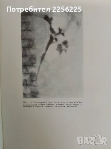 "Болести на бъбреците", снимка 4 - Специализирана литература - 47482021