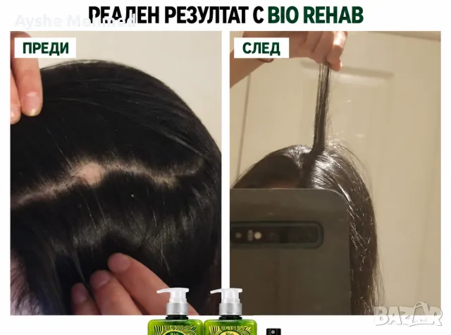 комплек за растеж био рехаб, снимка 7 - Продукти за коса - 56117520