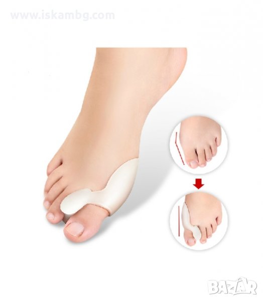 СИЛИКОНОВИ РАЗДЕЛИТЕЛИ СРЕЩУ ИЗПЪКНАЛИ КОКАЛЧЕТА - код FOOTMATE, снимка 1