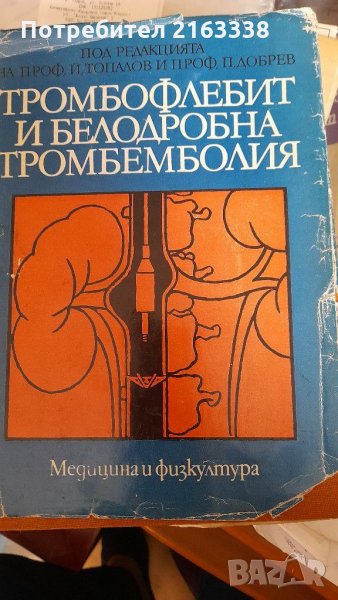 ТРОМБОФЛЕБИТ И БЕЛОДРОБНА ТРОМБЕМБОЛИЯ от проф.Й.Топалов, и проф.П.Добрев, снимка 1