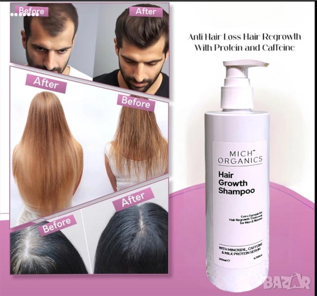 Миноксидил шампоан, снимка 1