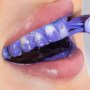 Избелване на зъби с цветен коректор V34, снимка 1 - Други - 42667586