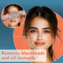 Нови Носови Лепенки за Почистване на Пори – Черни Точки, Всички Кожи, снимка 4