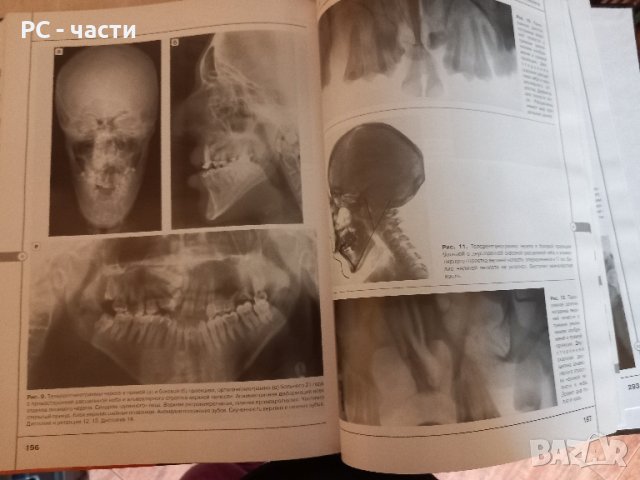 Лицево-челюстна Хирургия - Атлас с рентгенографии Рабухина, Аржанцев, 2002 год., снимка 7 - Специализирана литература - 43953146