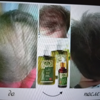 натурална козметика за растеж на косата, снимка 4 - Продукти за коса - 44698243