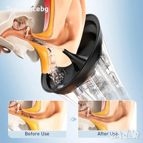 Електрическа система за отстраняване на ушна кал, инструмент за почистване на уши с водно захранване, снимка 3 - Други - 54072826