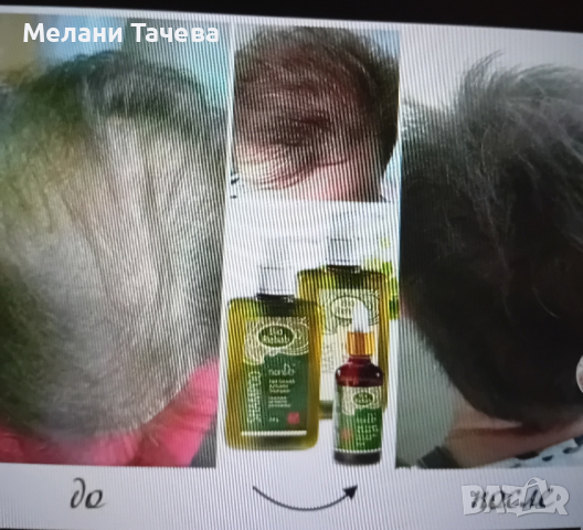 натурална козметика за растеж на косата, снимка 4 - Продукти за коса - 44698243