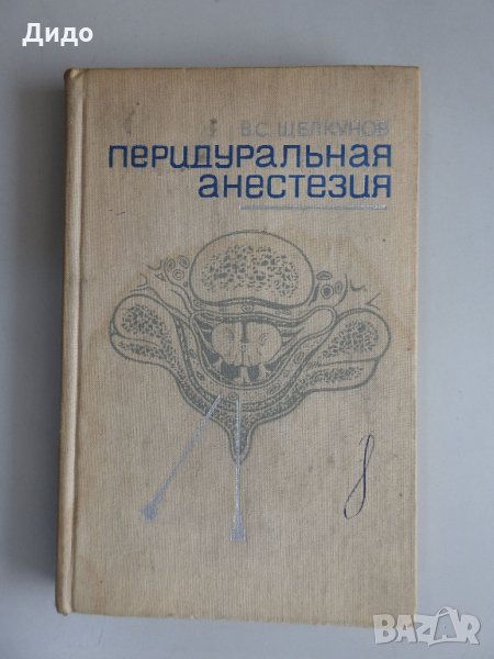 Перидуральная анестезия - Щелкунов, снимка 1