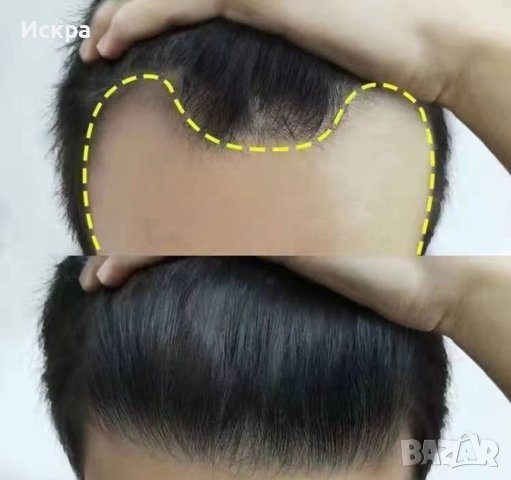Японски спрей за растеж и сгъстяване на косата , снимка 2 - Продукти за коса - 42907704