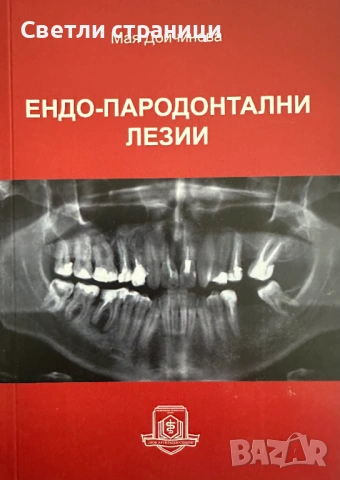 Ендо-пародонтални лезии