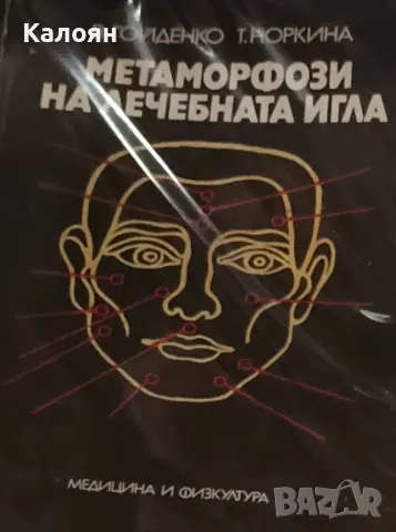 В. Гойденко, Т. Норина - Метаморфоза на лечебната игла (1989)