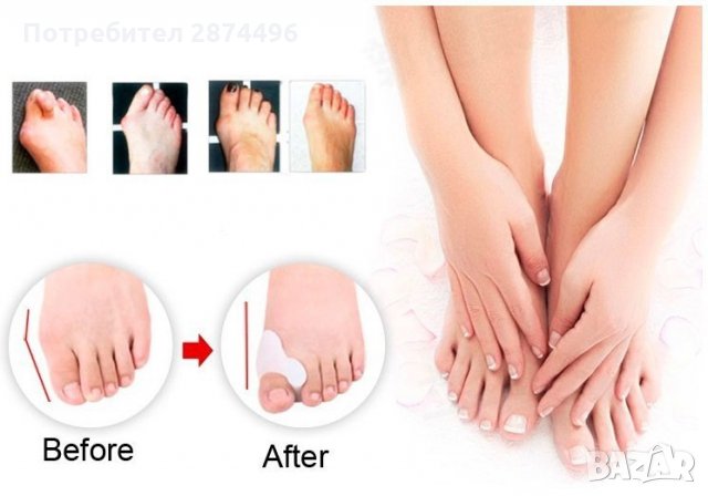 Силиконов разделител за кокалче за крака, снимка 10 - Други стоки за дома - 30912647