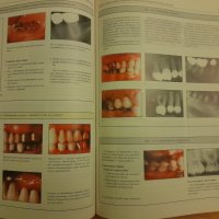 Основи на пародонтологията - Уилсон , Корнман - 1999г. ,470стр., снимка 5 - Специализирана литература - 42554802
