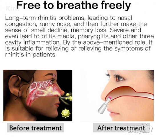 BioNase БиоНасе уникален уред за лазерна терапия и лечение на хрема, алергичен ренинт и синузит, снимка 9 - Други - 39778075