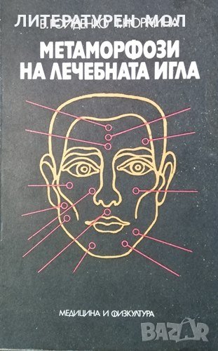 Метаморфози на лечебната игла. В. Гойденко, Т. Норкина, 1989г., снимка 1