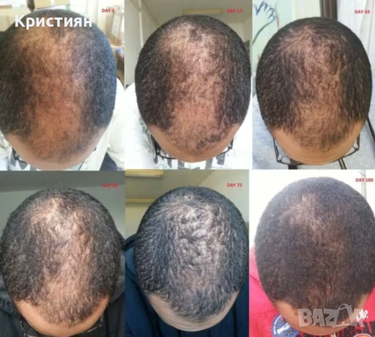 Kirkland Minoxidil - Разтвор против косопад Лечение 6 месеца 6 X 60гр, снимка 2 - Други - 50464499