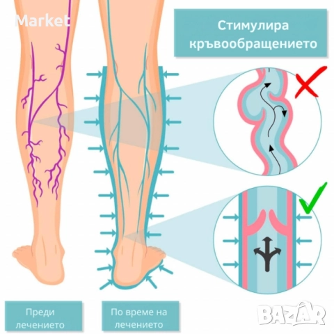 Апарат за венозна тренировка и облекчение на тежестта в краката Venen Walker Basic, снимка 2 - Уреди за диагностика - 51851372