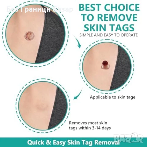 Нов Комплект за безопасно премахване на тагове – без болка у дома, снимка 6 - Други - 51106835