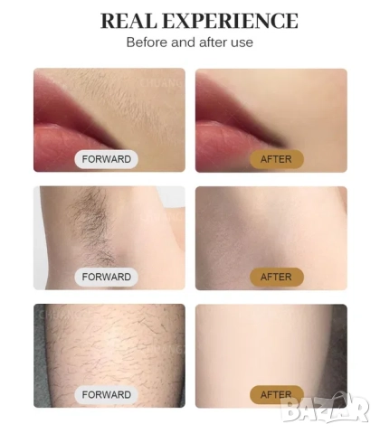 Диоден лазерен епилатор с охлаждане Soprano, 3 дължини на вълната, 3000W/4000W, снимка 7 - Козметични уреди - 52083757