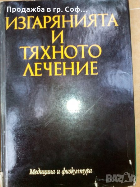 Изгарания и тяхното лечение, снимка 1