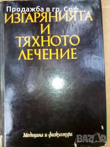 Изгарания и тяхното лечение, снимка 1