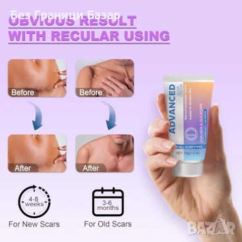 Нов Интензивен крем за белези и стрии – изглаждане и възстановяване на кожата, снимка 6 - Други - 51905727