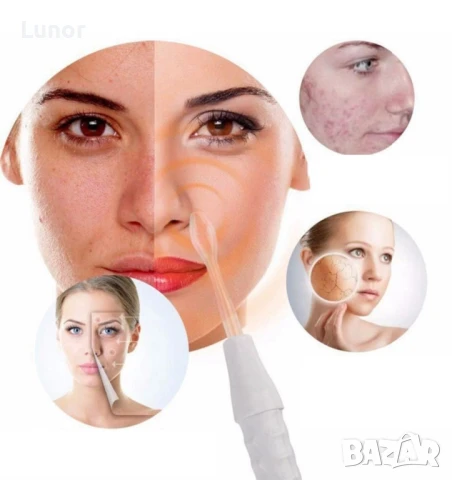 Дарсонвал за лице, снимка 3 - Козметични уреди - 51328110