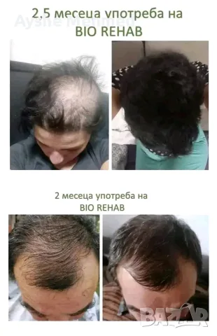 кажи край на косопада с комплект Bio Rehab
