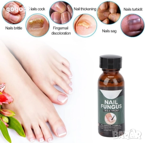 лак против гъбички , снимка 16 - Други - 51861216