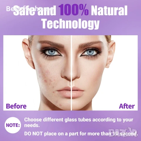 UUPAS Преносима високочестотна машина за лице за  акне, подмладяване, бръчки, снимка 5 - Други - 50747821