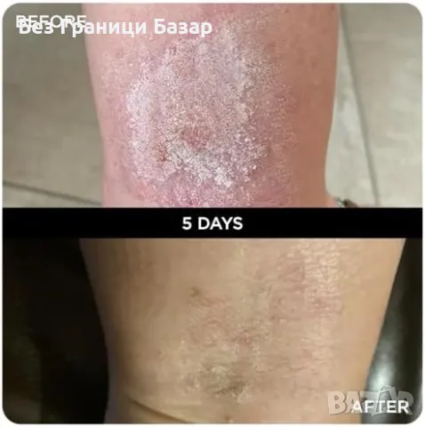 Нов Лек и бързо попиващ балсам за всекидневна грижа – 100% натурален, снимка 3 - Други - 48165122