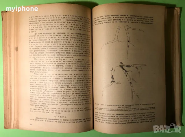 Стара Книга Частна Патологична Анатомия Сърце и Кръвоносни Съдове, снимка 7 - Специализирана литература - 49204157
