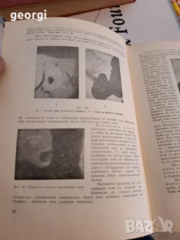 стар учебник по вътрешни болести 1957г. 2 тома    2/5, снимка 6 - Антикварни и старинни предмети - 47776717