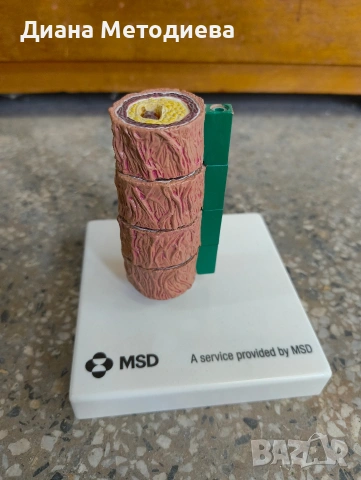 Анатомичен модел на кръвоносен съд (артерия) – медицински учебен модел, снимка 4 - Други стоки за дома - 54287638