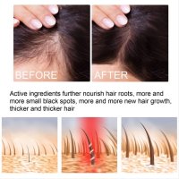 Многофункционален продукт за коса – растеж, заздравяване и сгъстяване , снимка 6 - Продукти за коса - 42847531