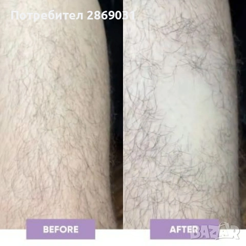 Компактен кристален уред за премахване на излишното окосмяване, снимка 5 - Козметика за тяло - 53876385