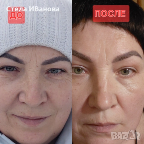 Комплект против бръчки, стареене на кожата, умора