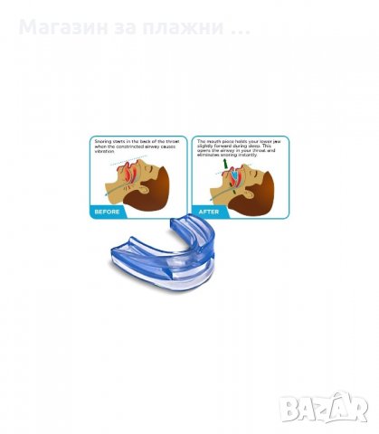 ШИНА-ОРТЕЗА ПРОТИВ ХЪРКАНЕ - код 1102