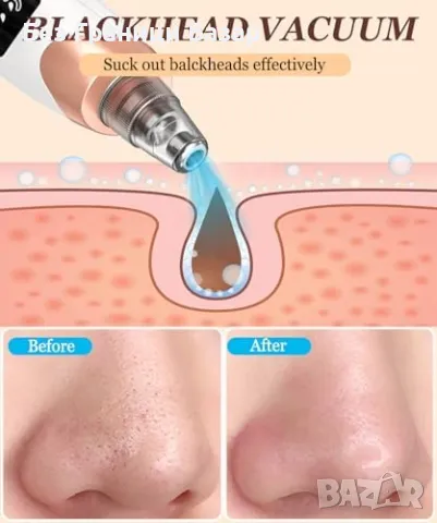 Нов USB Вакуум уред за почистване на пори черни точки акне лице кожа, снимка 5 - Други - 47294665