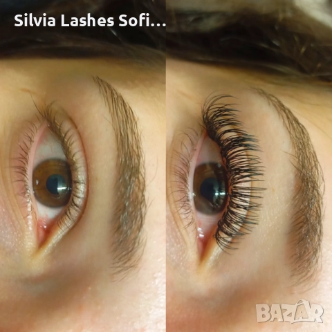 Миглопластика и масажи по домовете София , снимка 4 - Масажи - 52330865