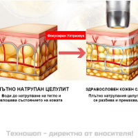 Лифтинг и подмладяване на кожата с уред V-Max Hifu - TS5624, снимка 5 - Козметични уреди - 44664873