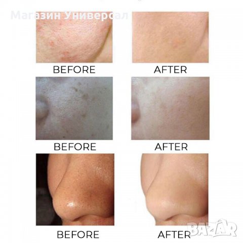 Водоустойчива четка за лице с батерия, USB презареждаема, 3в1 електрическа за почистване на кожата, снимка 6 - Масажори - 29689992