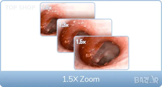 Медицински отоскоп с дисплей ScopeAround M28, снимка 12 - Медицинска апаратура - 49106096