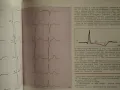 Ръководство по Електрокардиография, снимка 4