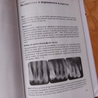Дентални  рентгенови  снимки -интерпретиране, снимка 3 - Специализирана литература - 43920187