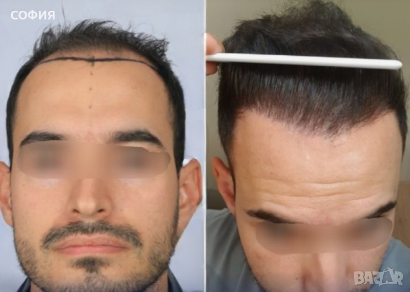 ПРОМОЦИЯ! Мъжки системи от естествена коса, снимка 1