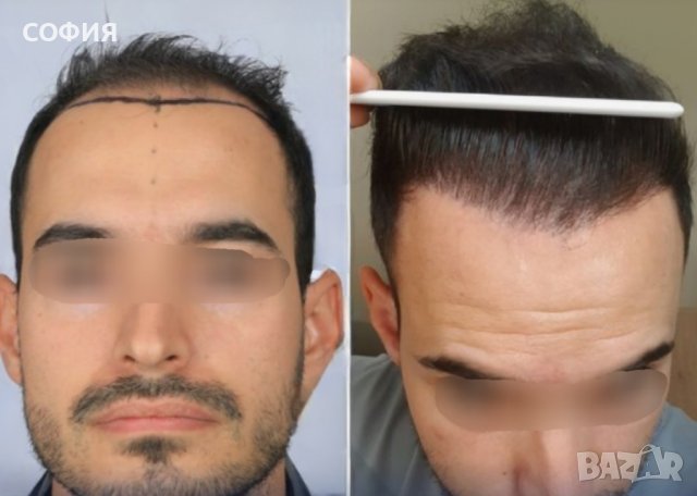ПРОМОЦИЯ! Мъжки системи от естествена коса